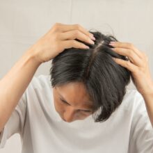 医師が実体験で語る！AGA治療の真実と驚きの効果　薄毛に悩む前に知っておきたい最新治療法